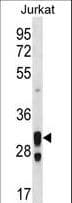 ACER1 / ASAH3 Antibody (aa236-263)