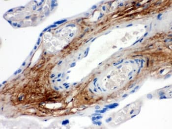 TNXB / Tenascin XB Antibody