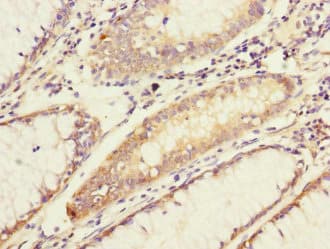 ADCY4 / Adenylate Cyclase 4 Antibody