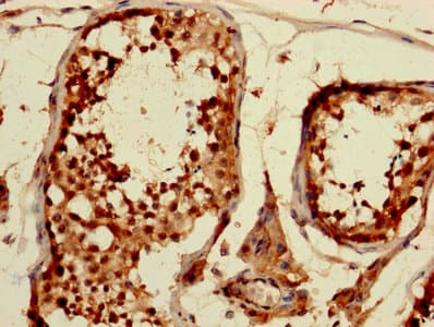 CDKN1A / WAF1 / p21 Antibody