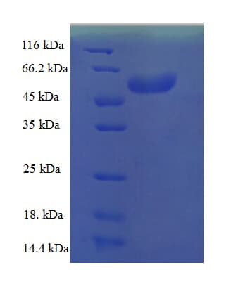 Human SOX2 Protein (Recombinant His-SUMO)