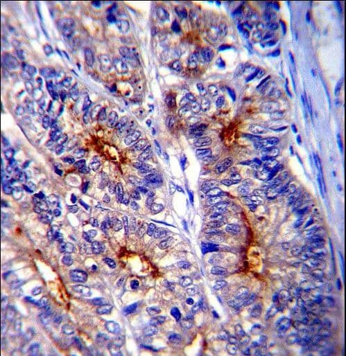 LGALS3 / Galectin 3 Antibody (aa163-191)