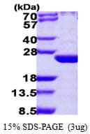 Human ARL6 Protein (Recombinant His)