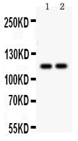 ATP2A3 / SERCA3 Antibody (aa1-30)
