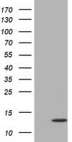 Monoclonal Mouse anti-Human FSHB / FSH Beta Antibody (clone OTI4E10, WB)