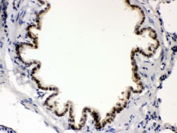 BMP5 Antibody