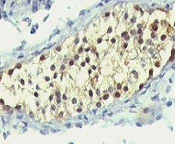 TS / Thymidylate Synthase Antibody (clone SPM453)