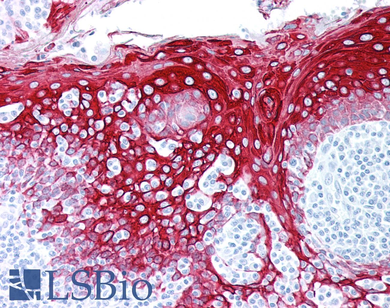 IHC-plus™ Cytokeratin 5+6 Antibody (clone ABT-CK5/6)
