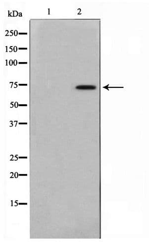 Polyclonal Rabbit anti-Human AKAP10 Antibody (WB)
