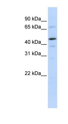 Polyclonal Rabbit anti-Human GTF2E1 Antibody (aa108-157, WB)