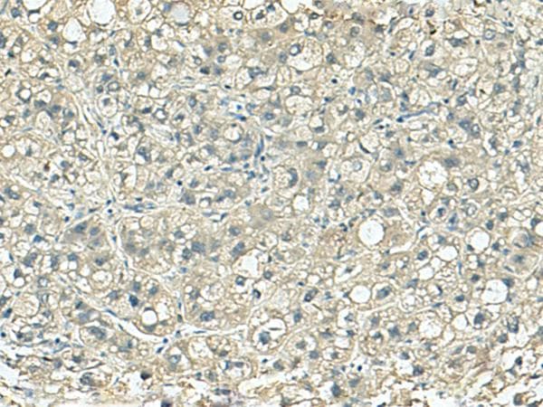 SORBS2 / ARGBP2 Antibody