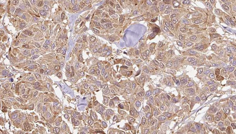 SERPINB5 / Maspin Antibody