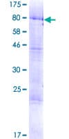 Human TRM6 / TRMT6 Protein (Recombinant GST)