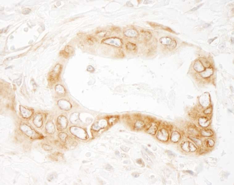 Polyclonal Rabbit anti-Human UVRAG Antibody (aa649-699, IHC, WB)
