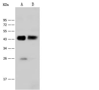 Polyclonal Rabbit anti-Human KRT18 / CK18 / Cytokeratin 18 Antibody (Preservative Free, IHC, WB)