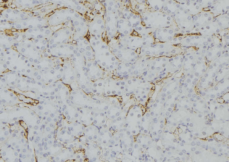 Polyclonal Rabbit anti-Human RAB33B Antibody (IHC, WB)