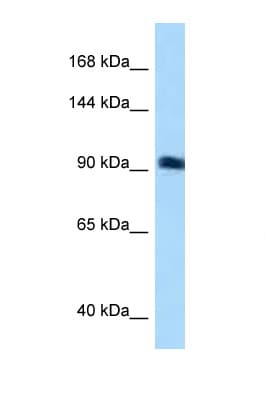 Polyclonal Rabbit anti-Human ARHGEF26 / SGEF Antibody (N-Terminus, WB)