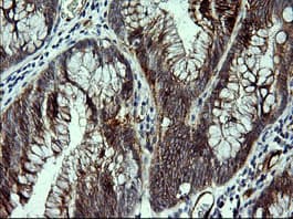 CDH3 / P-Cadherin Antibody (clone 2D5, Carrier-free)