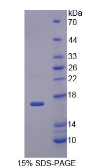 Rat Nor-1 / NR4A3 Protein (Recombinant His-T7)