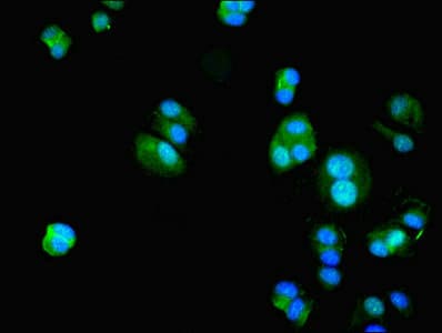 HIF1AN Antibody