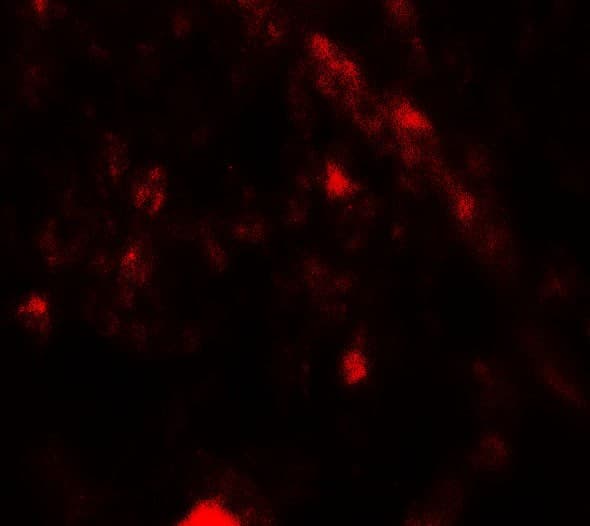 IHC-plus™ Polyclonal Rabbit anti-Human PIK3R4 Antibody (IHC, IF, WB)