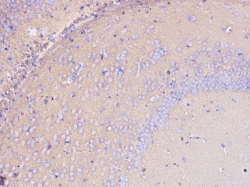 Polyclonal Rabbit anti-Human PRKCG / PKC-Gamma Antibody (IHC, WB)