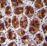 Polyclonal Rabbit anti-Human SERTAD4 Antibody (aa265-293, IHC, WB)