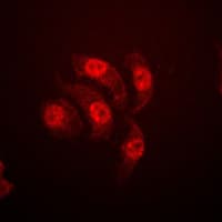 ETS1 / ETS-1 Antibody (phospho-Thr38)