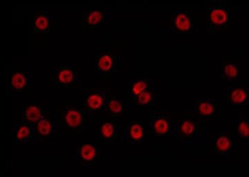 ANP32C Antibody