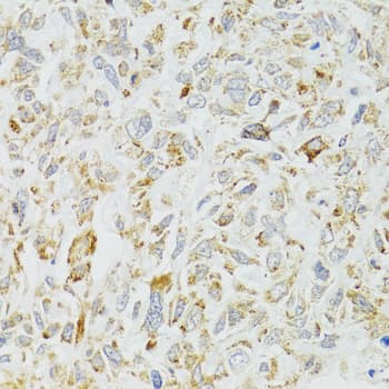 Polyclonal Rabbit anti-Human DICER1 / Dicer Antibody (IHC, WB)