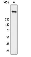 RYR2 / Ryanodine Receptor 2 Antibody (phospho-Ser2808)