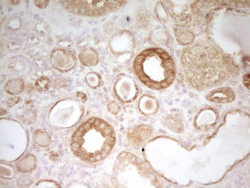 Monoclonal Mouse anti-Human PAK4 Antibody (clone OTI1C7, aa1-308, IHC, WB)