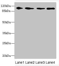 GRIK3 / GLUR7 Antibody