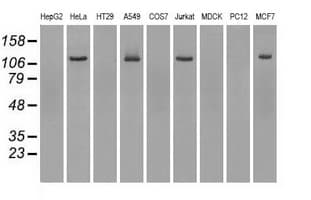 BUB1B / BubR1 Antibody (clone OTI10E7)