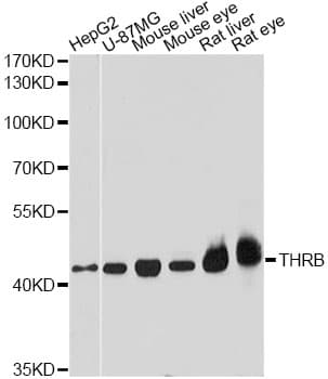 Polyclonal Rabbit anti-Human NR1A2 / THRB Antibody (IHC, WB)