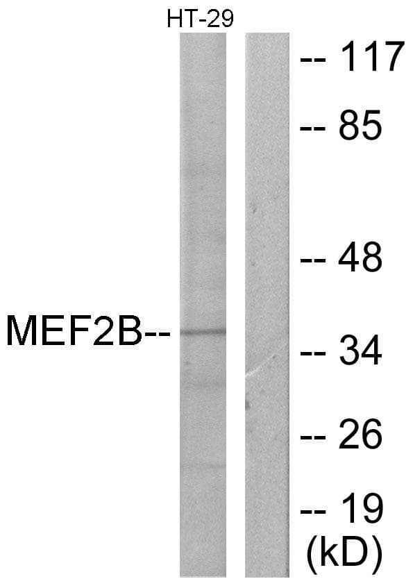 MEF2B Antibody