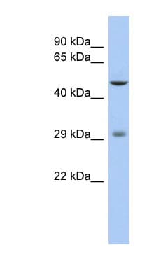 LBX1 Antibody (aa71-120)