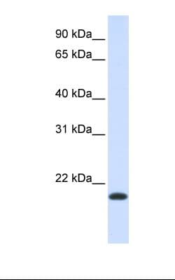 Polyclonal Rabbit anti-Human NKAIN1 Antibody (HRP, aa118-167, WB)