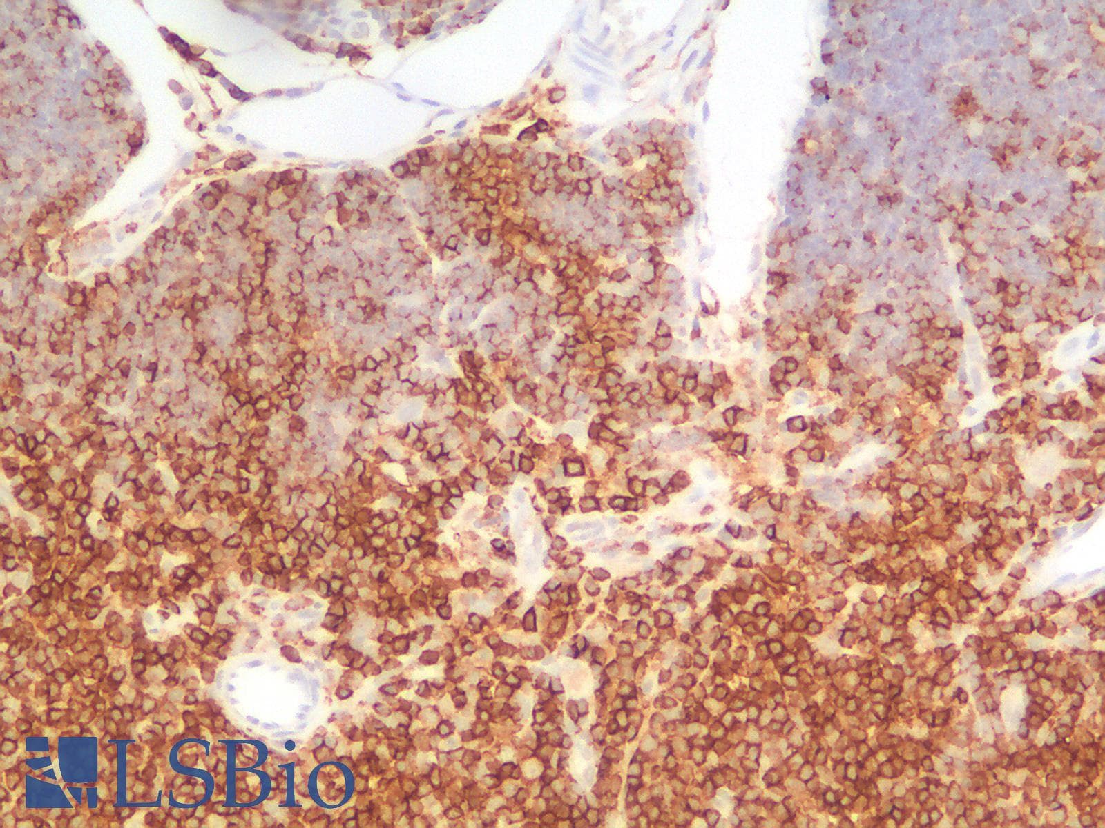 PathPlus™ CD45RB Antibody (clone PTPRC/2877R)