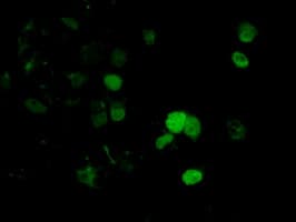 DNTTIP1 / TDIF1 Antibody (clone OTI1D3)