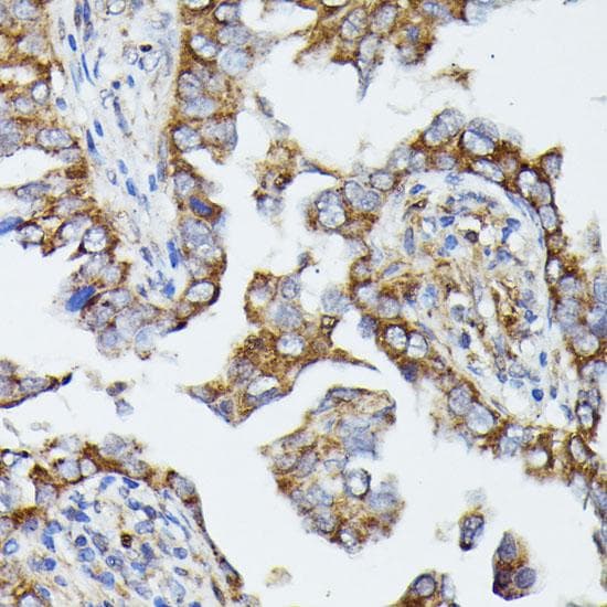 MTIF2 Antibody