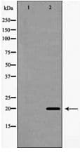 IL20 Antibody