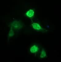 Monoclonal Mouse anti-Human CD163 Antibody (clone 2G12, IHC, IF, WB)