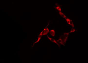 RPS6KB1 / P70S6K / S6K Antibody