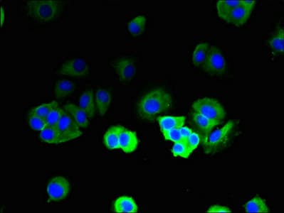 TRBC1 Antibody (aa1-177)