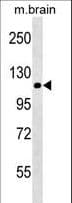 NLRP12 Antibody