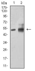 ALDH1A1 / ALDH1 Antibody (clone 2B2G1)