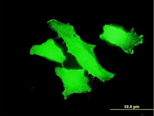 MPP1 Antibody (clone 1E11-1G11)