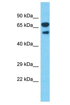 DARS Antibody (aa396-445)