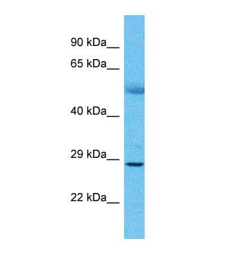 Polyclonal Rabbit anti-Human KIR3DS1 / NKB1 Antibody (aa41-90, WB)